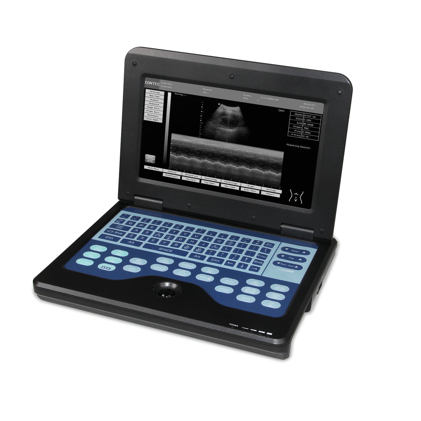 CMS600P2 Portable Laptop Ultrasound Scanner | Full Digital B-Ultrasound System