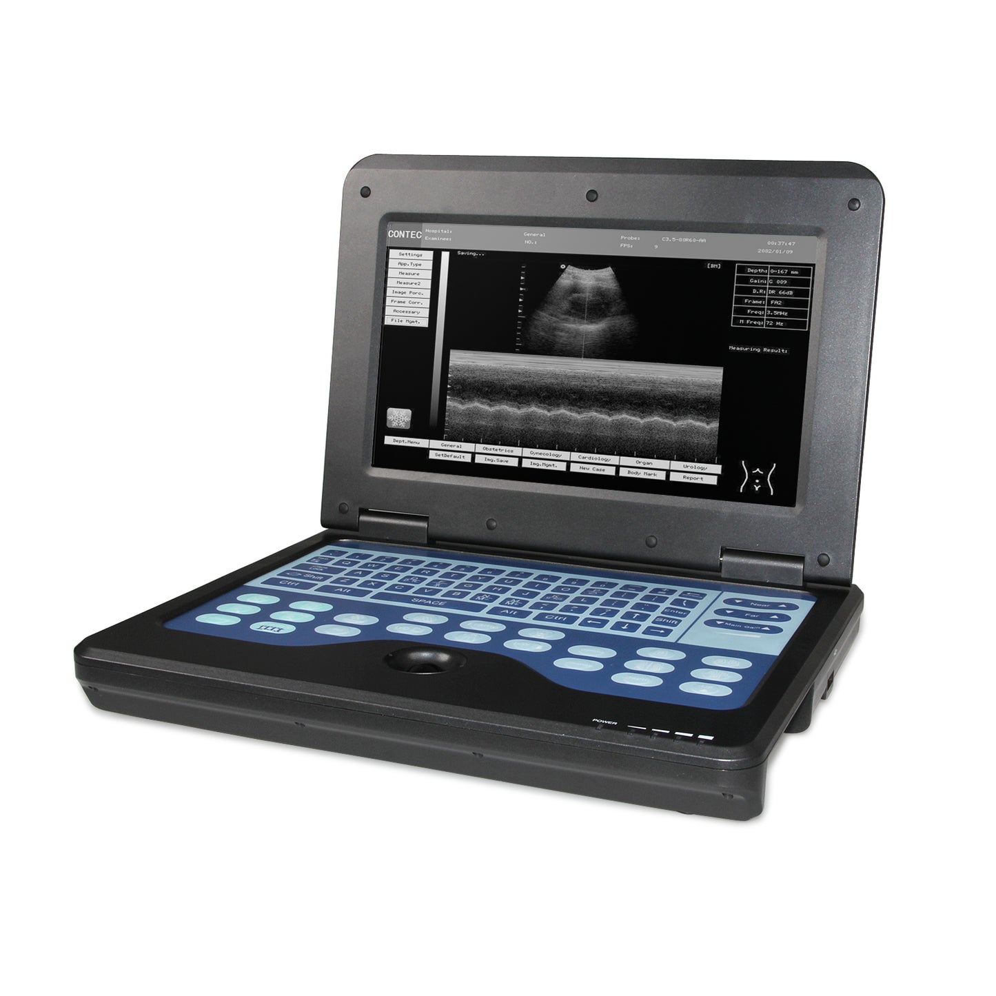 CMS600P2 Portable Laptop Ultrasound Scanner | Full Digital B-Ultrasound System