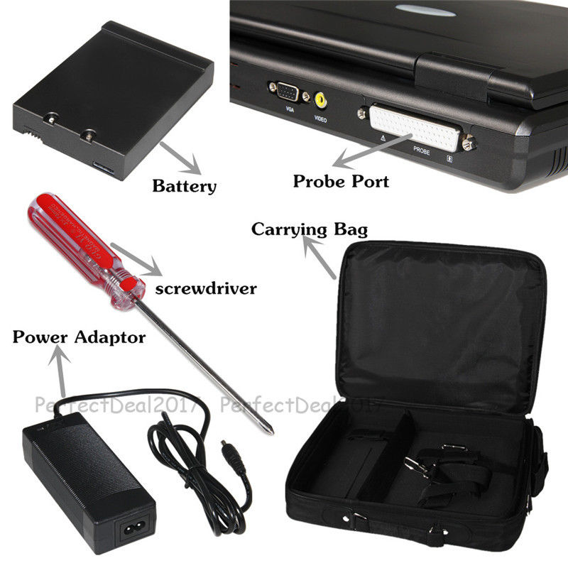 CMS600P2 Portable Laptop Ultrasound Scanner | Full Digital B-Ultrasound System