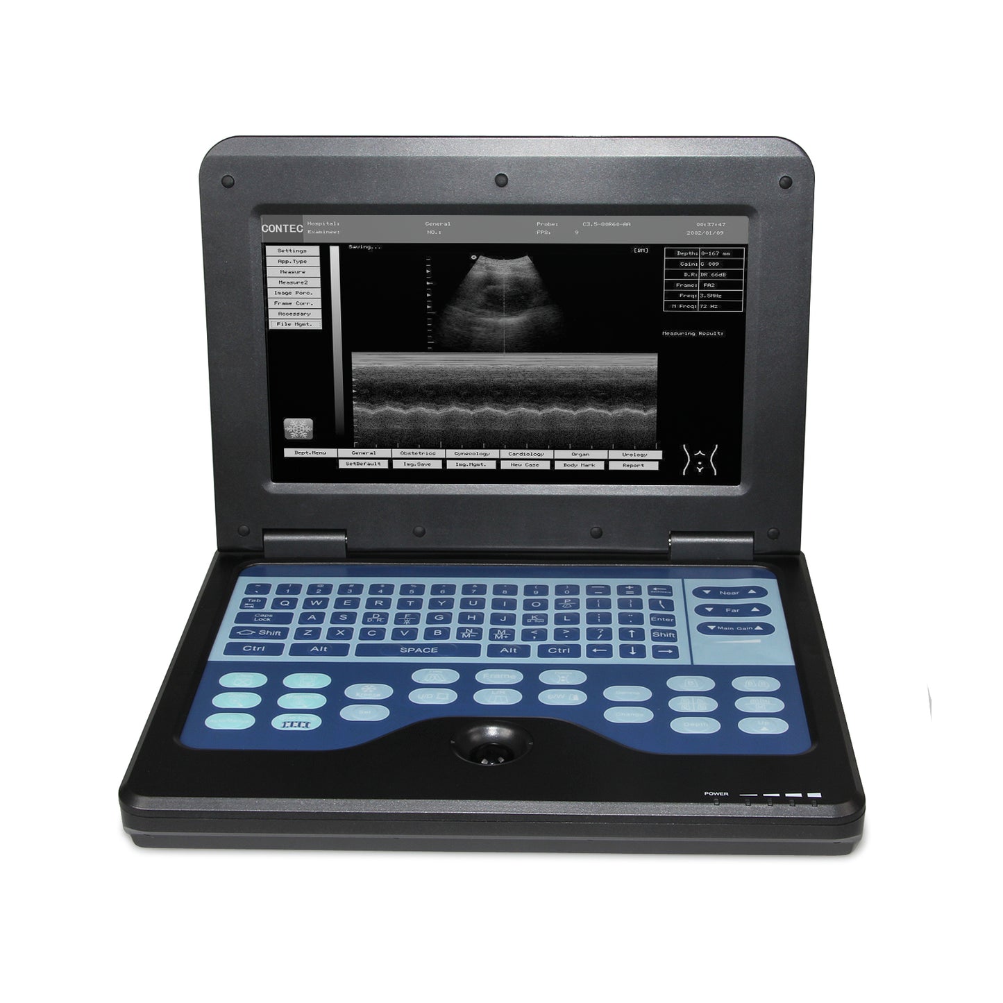 CMS600P2 Portable Laptop Ultrasound Scanner | Full Digital B-Ultrasound System