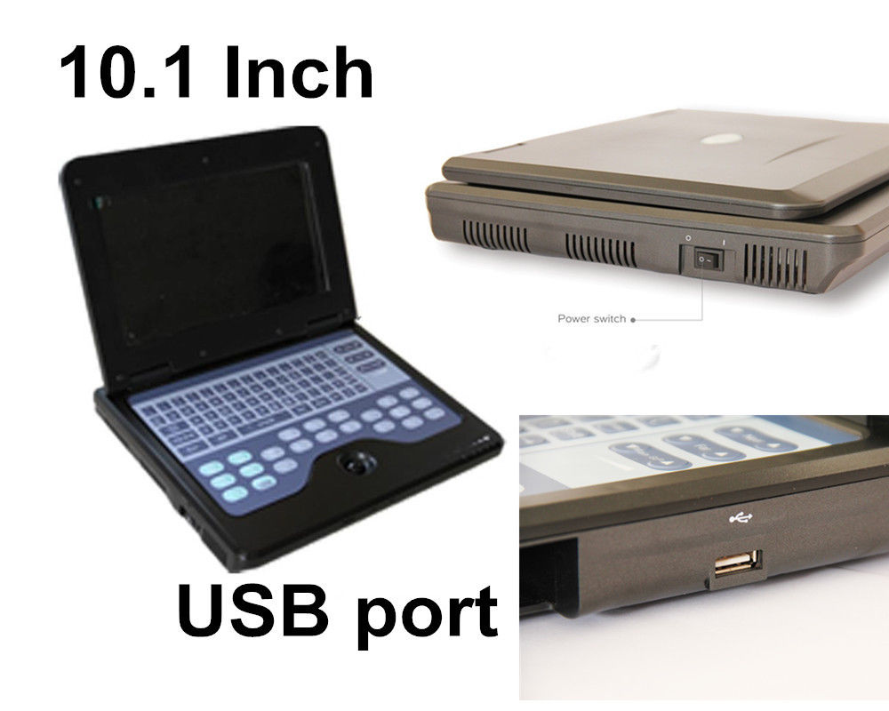 CMS600P2 Portable Laptop Ultrasound Scanner | Full Digital B-Ultrasound System